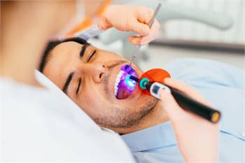 Know Everything Related To Dental Sealants